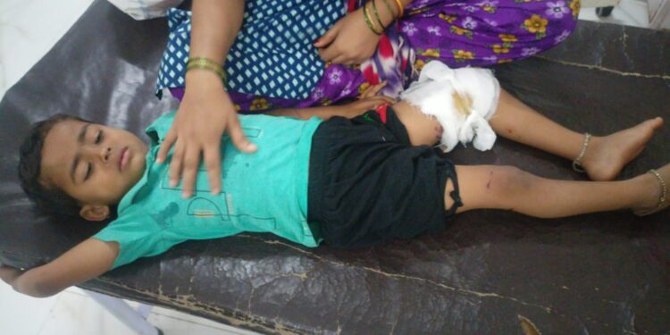 सोलापूर शहरातील धुमावस्तीमध्ये कुत्र्याने घेतला तिघांचा चावा